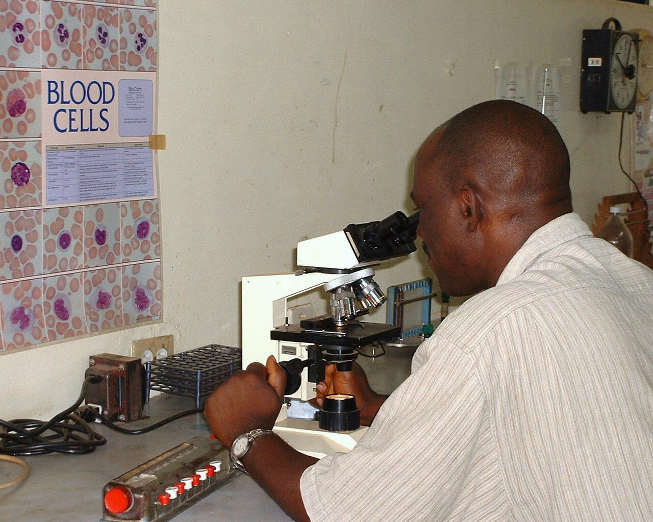 A lab worker at a hospital in Jos, Nigeria, looks through a microscope; file photo